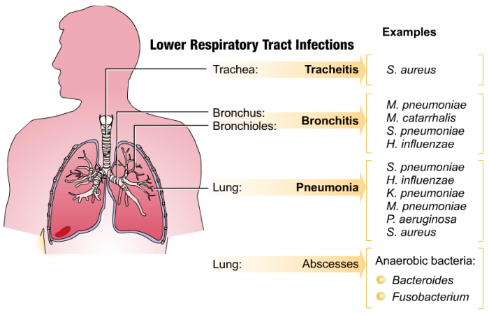 Respiratory alkalosis acidosis metabolic abg mnemonics rn mnemonic medical studyblue hco3 symptom hyperventilation resp dpt flashcards pulmonary pathology study nurseslabs