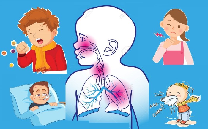 The prodromal syndrome consists of all of the following except